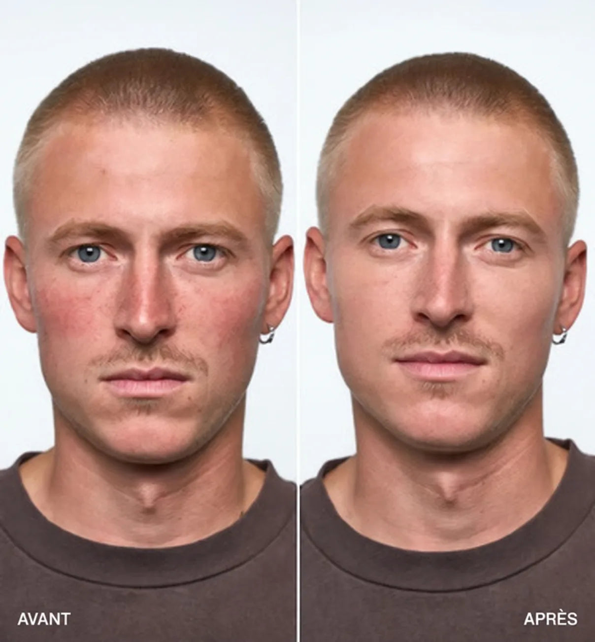 concealing-cream-7323917 1.png__PID:92f83c41-f7ac-4f68-9317-450f34afba1f